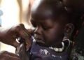 Nearly 700 Dead as Measles ravages Zimbabwe