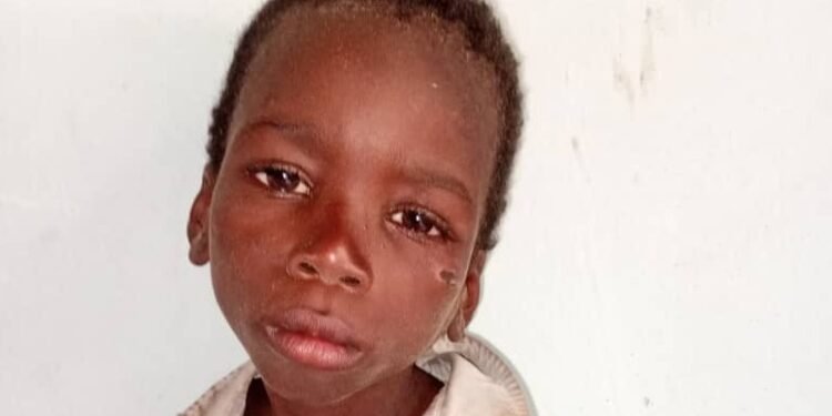 Seven Year Old Boy Tied to Tree for Several Days by Kidnappers Rescued in Yobe | METROWATCH