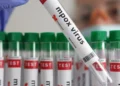 Sierra Leone Records Index Case of Mpox